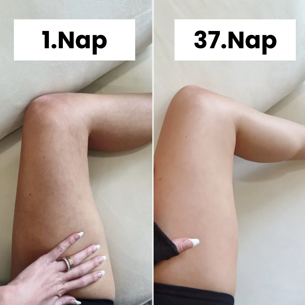Pakiet Startowy Napinaczy Ud